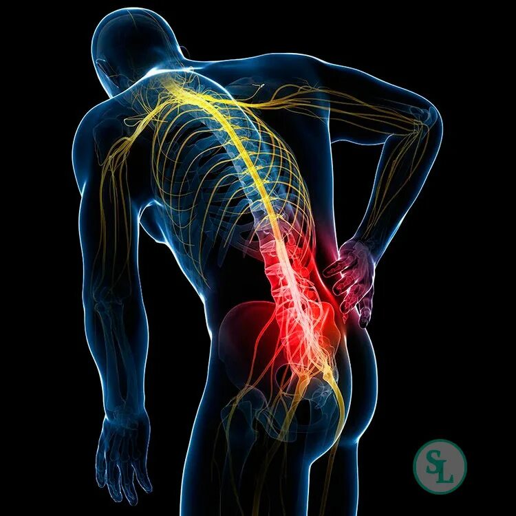 Сильная острая боль в пояснице. Боль в спине. Болит спина. Боль в позвоночнике. Больная спина.