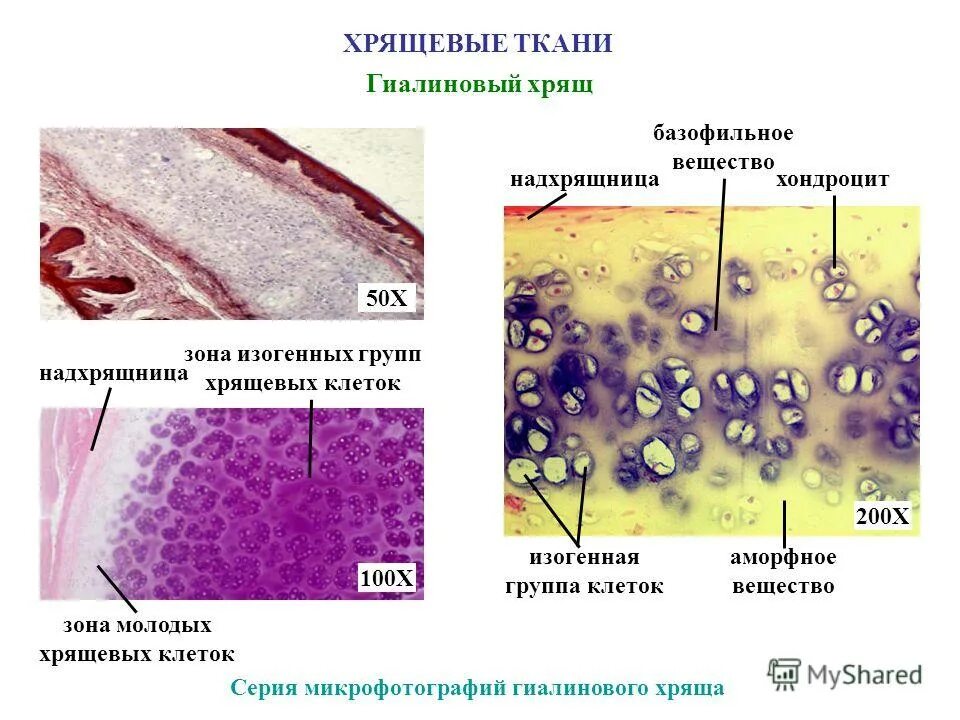 Изогенные группы. Гиалиновый хрящ базофильное вещество. Группа гиалинового хряща ткани. Изогенные группы хрящевой ткани. Гиалиновый хрящ ребра гистология.