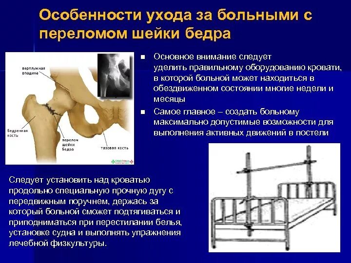 При переломе шейки бедренной кости. Положение при переломе шейки бедра. Закрытие перелом бедренной кости. Перелом бедренной кости операция. Последствия перелома шейки бедра