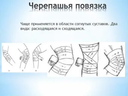 Что такое десмургия