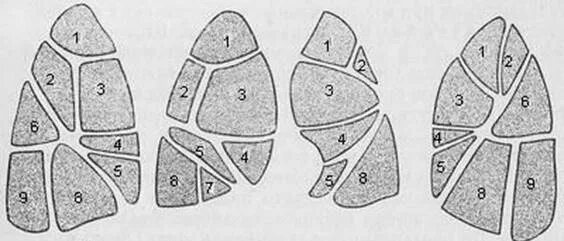 Сегментарное строение легких в прямой и боковой проекции. Сегменты легкого на кт. Сегменты легкого на рентгенограмме. Сегментарное строение легких рентген.