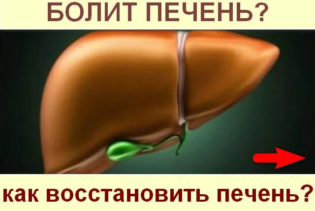 Ранние признаки цирроза печени. Симптомы церозапечент. Синдромы в клинической картине циррозов печени. Болезни печени симптомы и признаки. Синдромы в клинической картине циррозов печени.