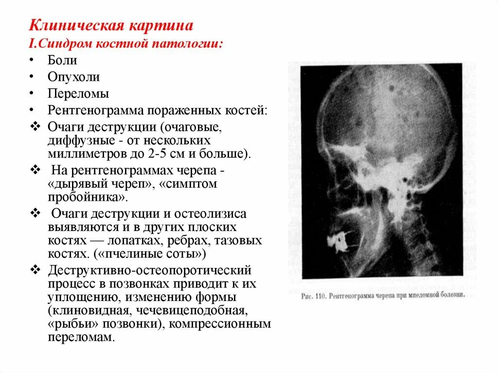 Боли в пояснице классификация. Патологическая боль характеристика. Аномалия боль. Виды патологической боли. Механизмы формирования патологической боли.
