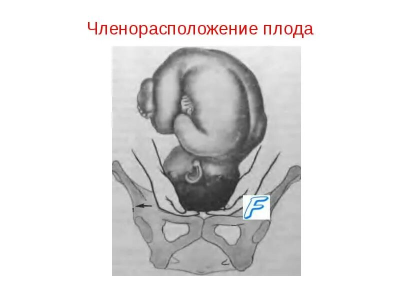 Членорасположение положение предлежание плода. Членорасполодерие плода. нормальное членорасположение плода. членорасположение плода акушерство. членорасположение положение плода.