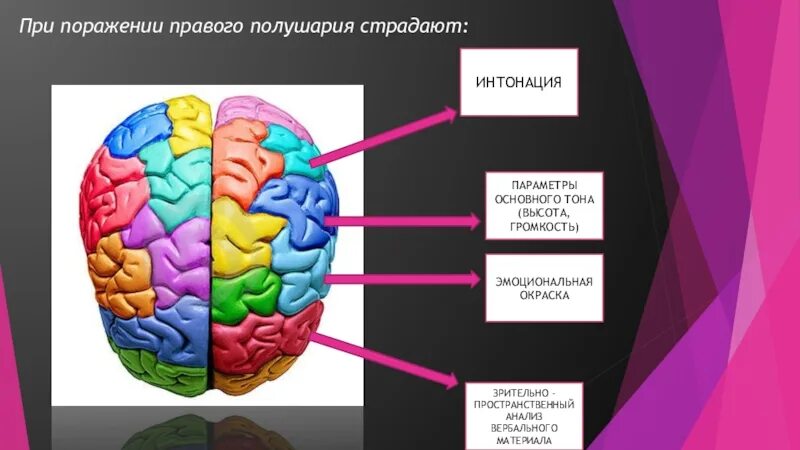 Речевое полушарие мозга