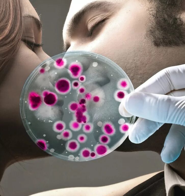 заболевания передающиеся половым путем. заболевания передающиеся пол путем обж. болезнь поцелуев мононуклеоз. заражение при разговоре. пути передачи вич через поцелуй.