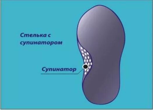 Нужен ли супинатор в обуви. Супинатор в обуви. Супинатор в ботинках. Супинатор в туфлях. Супинатор в обуви для детей.