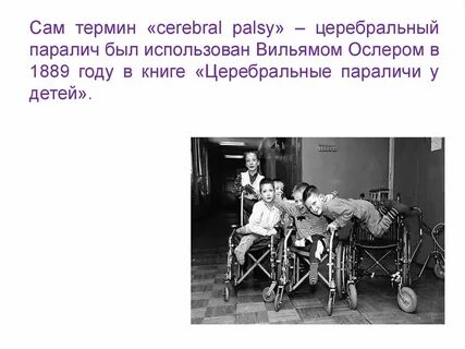 Термины дцп