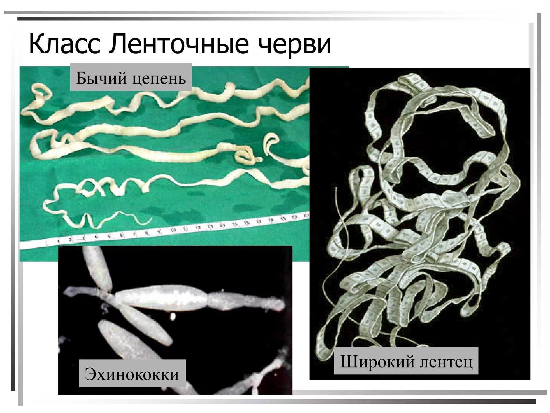 Ленточный червь бычий цепень. Стробила у ленточных червей это. Ленточный червь широкий лентец. Ленточные черви широкий лентец. Бычий цепень свиной цепень широкий лентец эхинококк.