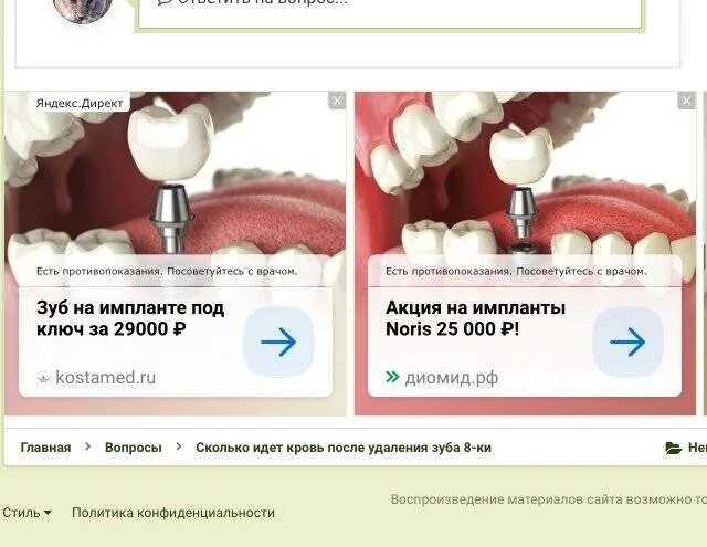 Через сколько дней удалять следующий зуб. После удаления зуба мудрости рекомендации. кровоточит после удаления зуба.