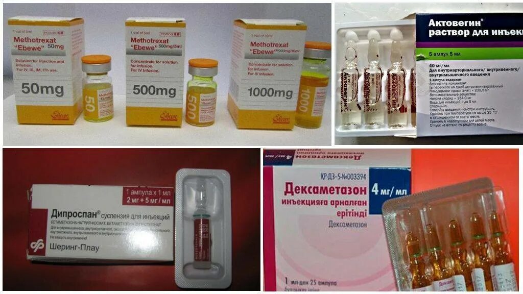 Что проколоть при болях в суставах