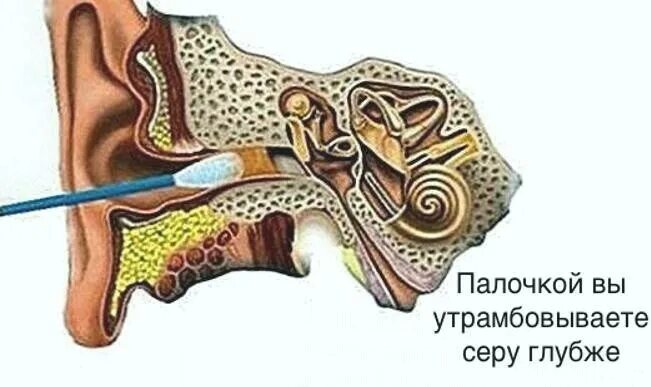 Ватной палочкой чищу