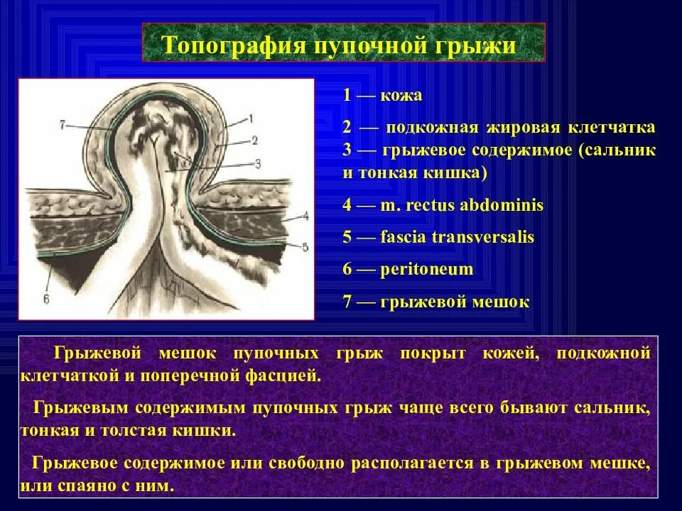 Хирургический латынь. Пупочная грыжа анатомия. Грыжи топографическая анатомия. Топография пупочной грыжи.