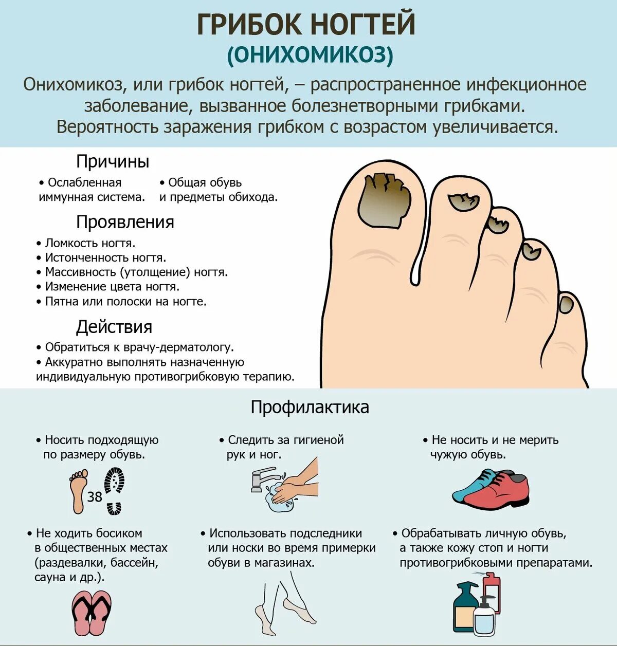 Как быстро избавиться от грибка на ногах. Грибковое поражение ногтей на ногах. грибок ногтей онихомикоз. грибок ногтей на ногах признаки. грибковые инфекции ногтей онихомикозы.