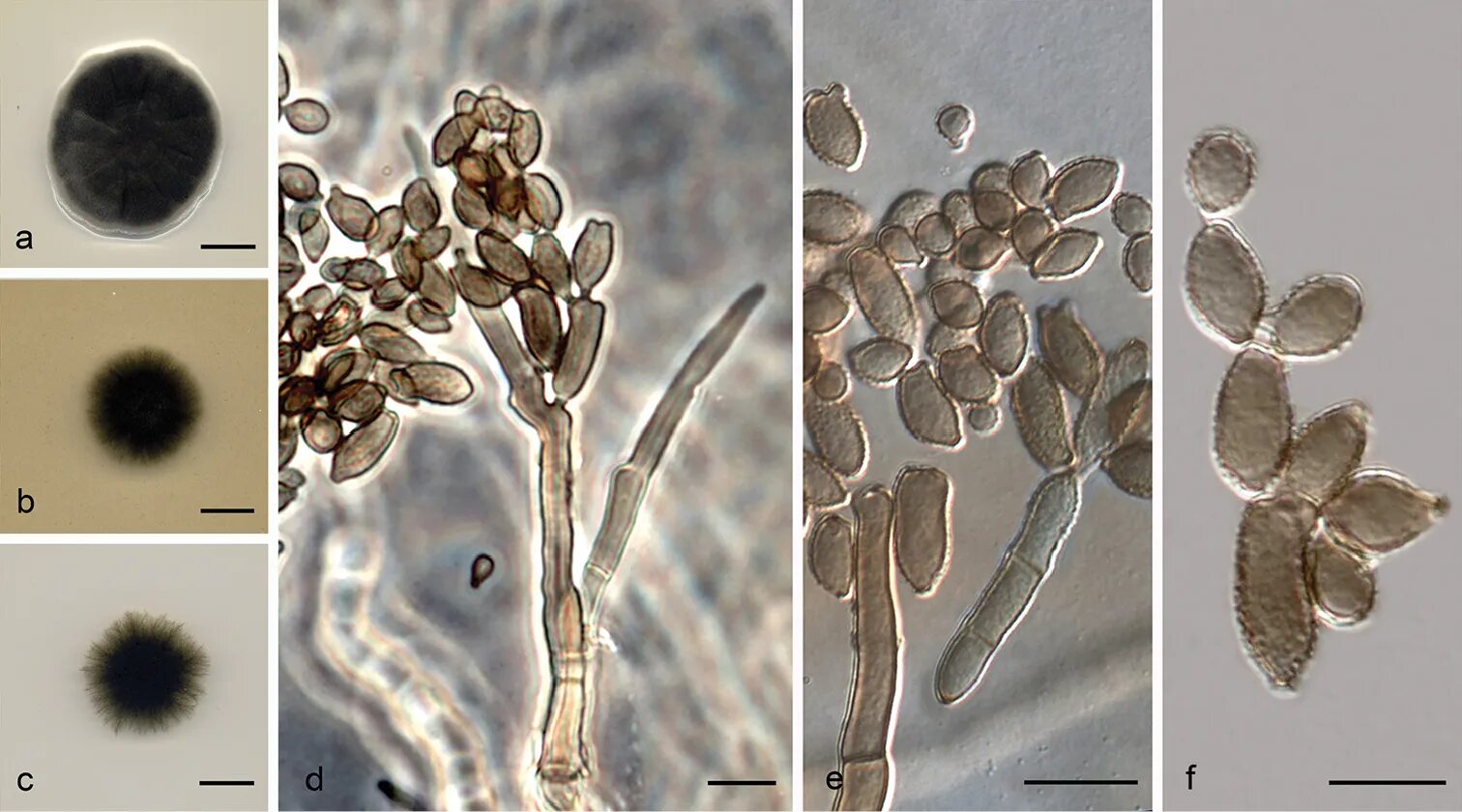 Плесневый гриб кладоспориум. Cladosporium herbarum. Кладоспориум растение. (cladosporium fulvum грибы. Плесень кладоспориум.
