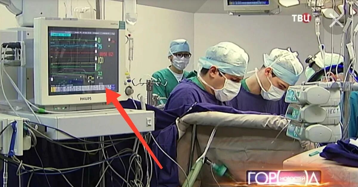 Рча сердца в бакулева. Андрос ош клиника. Терехов кардиолог саратов. Клиническое отделение. Рча сердца в бакулева.