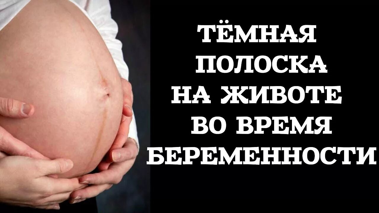 Почему на животе полосы. Полоска беременности тёмная на животе. Темная полоса на беременном животе. Полоса на животе у беременных пол ребенка.