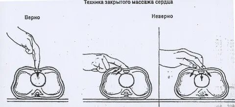 Верная техника