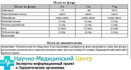 Мазок на микрофлору берут