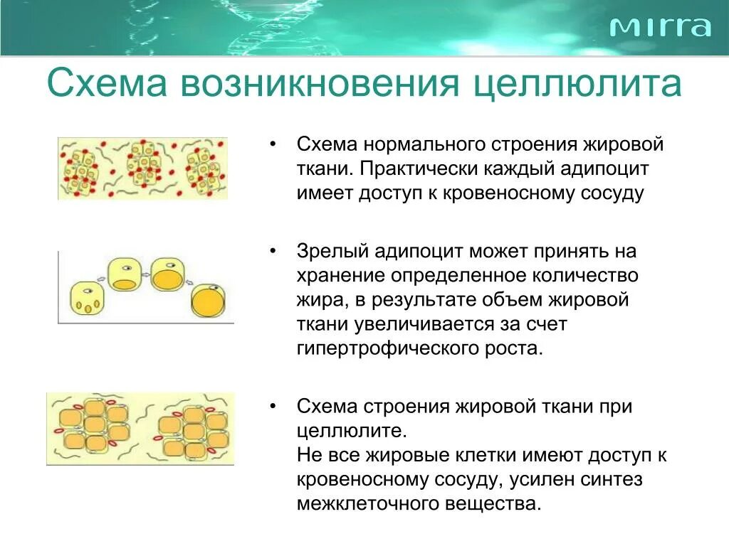 Жировая ткань схема. Целлюлит строение жировой ткани. Целлюлит схема. Бурая жировая ткань строение.