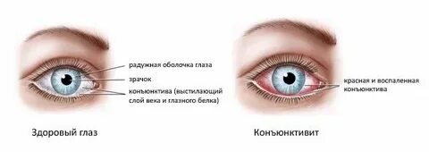 От коню коньюктивита