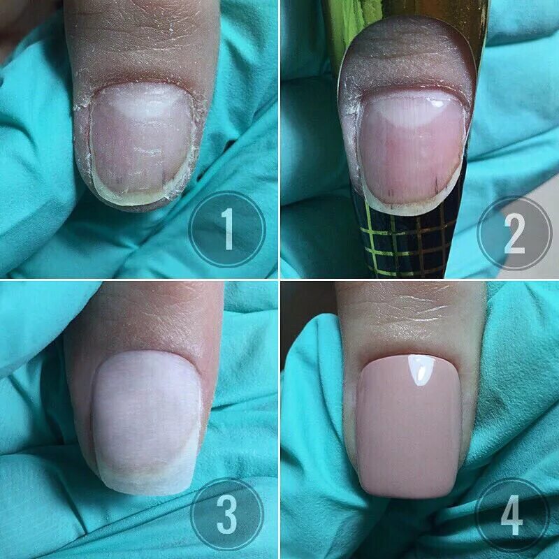Ногти до и после. Ногти до и после маникюра. Коррекция ногтей. Наращивание ногтевой пластины.
