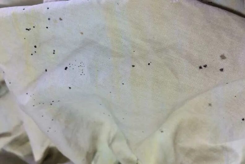 Пятна после стирки. Серые пятна на одежде. Желтые пятнышки на белой одежде. Пятна на одежде. Желтые пятна на одежде после стирки.