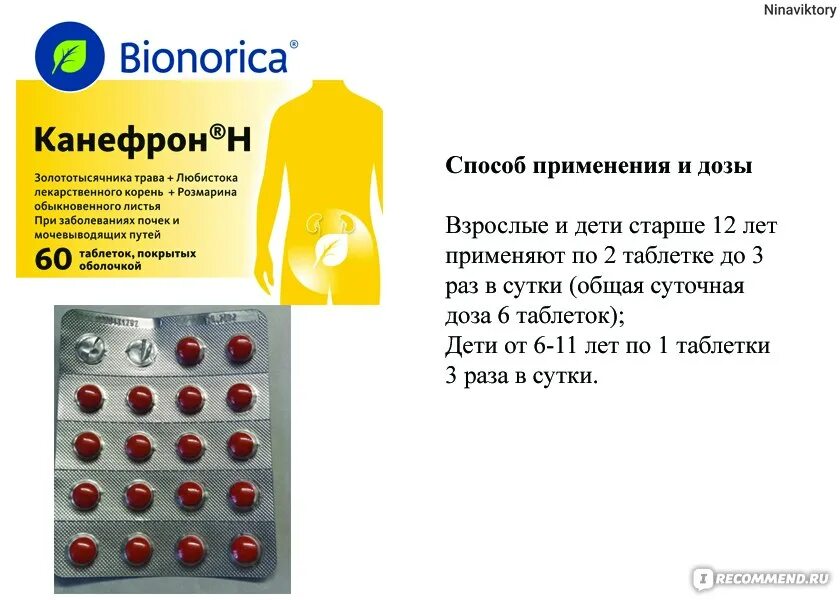 Цистит таблетки какие можно. Канефрон для беременных в таблетках. Препарат при цистите канефрон. Таблетки для мочевого канефрон. Таблетки при цистите у женщин канефрон.