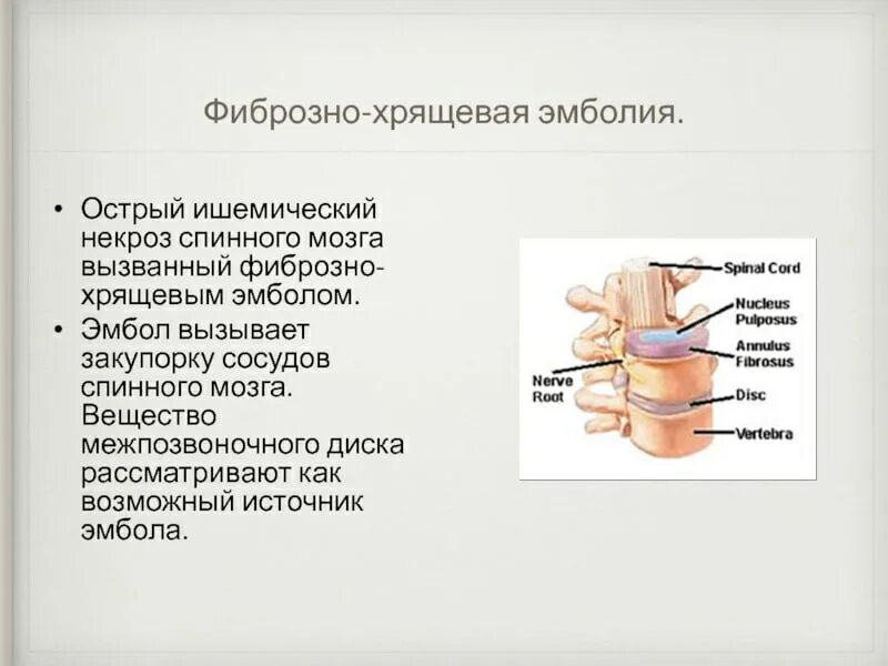 Фиброзно хрящевая эмболия у собак. Фиброзно хрящевая эмболия. фиброзно-хрящевая эмболия у кошек.