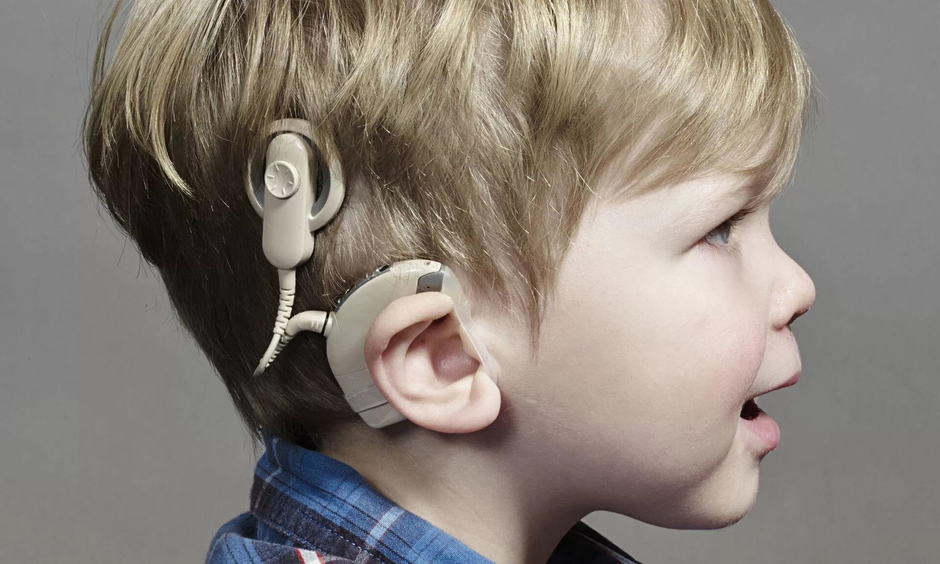 Слабослышащие 2.2. Кохлеарная имплантация Cochlear. Кохлеарный имплант аппарат. Кохлеарный имплант Кохлер. Слуховой аппарат кохлеарный имплант.