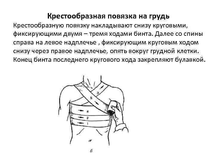 Наложение повязки на грудную клетку. Наложение повязки на грудную клетку