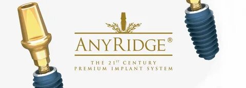 Anyridge импланты