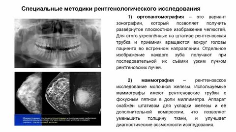Основные методы рентгенологического исследования
