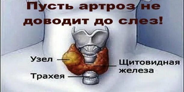 Как лечить узел
