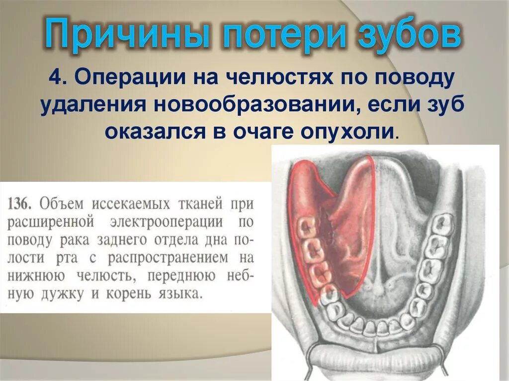 Почему теряет зубы. Почему теряет зубы