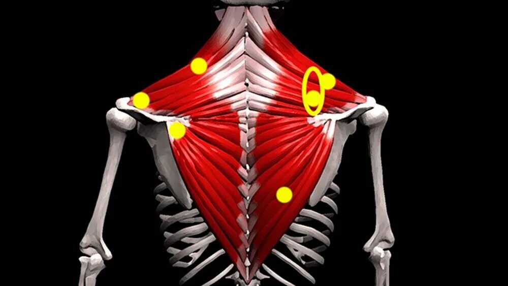 Мфр трапециевидной мышцы. Триггеры трапециевидной мышцы. Latissimus dorsi широчайшая мышца спины. Трапециевидная мышца шеи анатомия. Упражнения на трапециевидную мышцу.