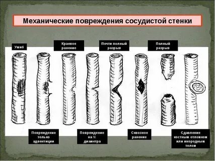 Механический сосуд