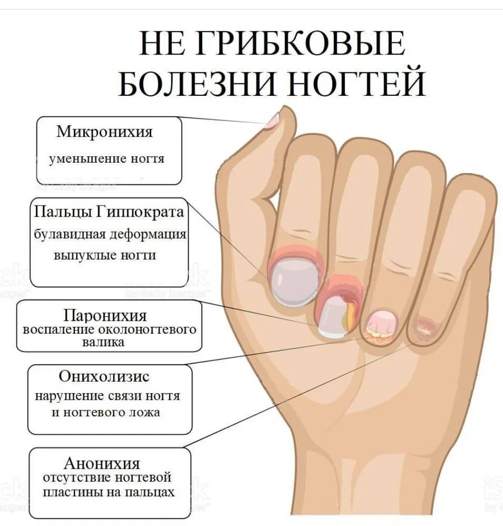 Проблема с ногтями к какому врачу обратиться. Болезни ногтей на руках таблица. Болезни по ногтям на руках таблица.