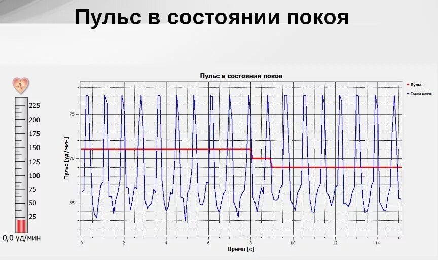 Картинки КАКОЙ НОРМАЛЬНЫЙ ПУЛЬС У ЧЕЛОВЕКА В ПОКОЕ