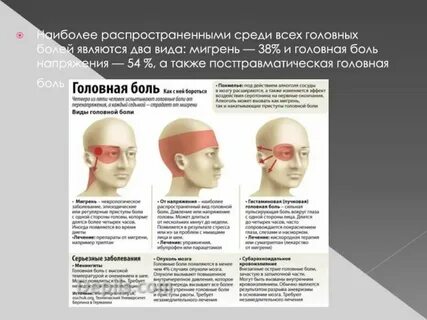 Болезнь головной боли как называется