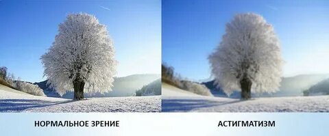 Зрение астигматизм как видит человек