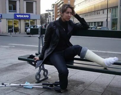 Фото девушек в гипсе нога