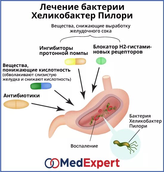 Как быстро снять приступ гастрита БОЛЯЧКИ: ЖКТ