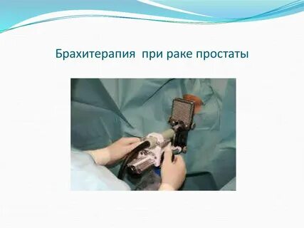 Брахитерапия рака отзывы пациентов