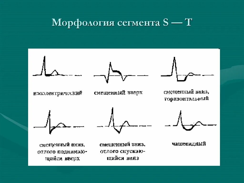 Признаки сррж