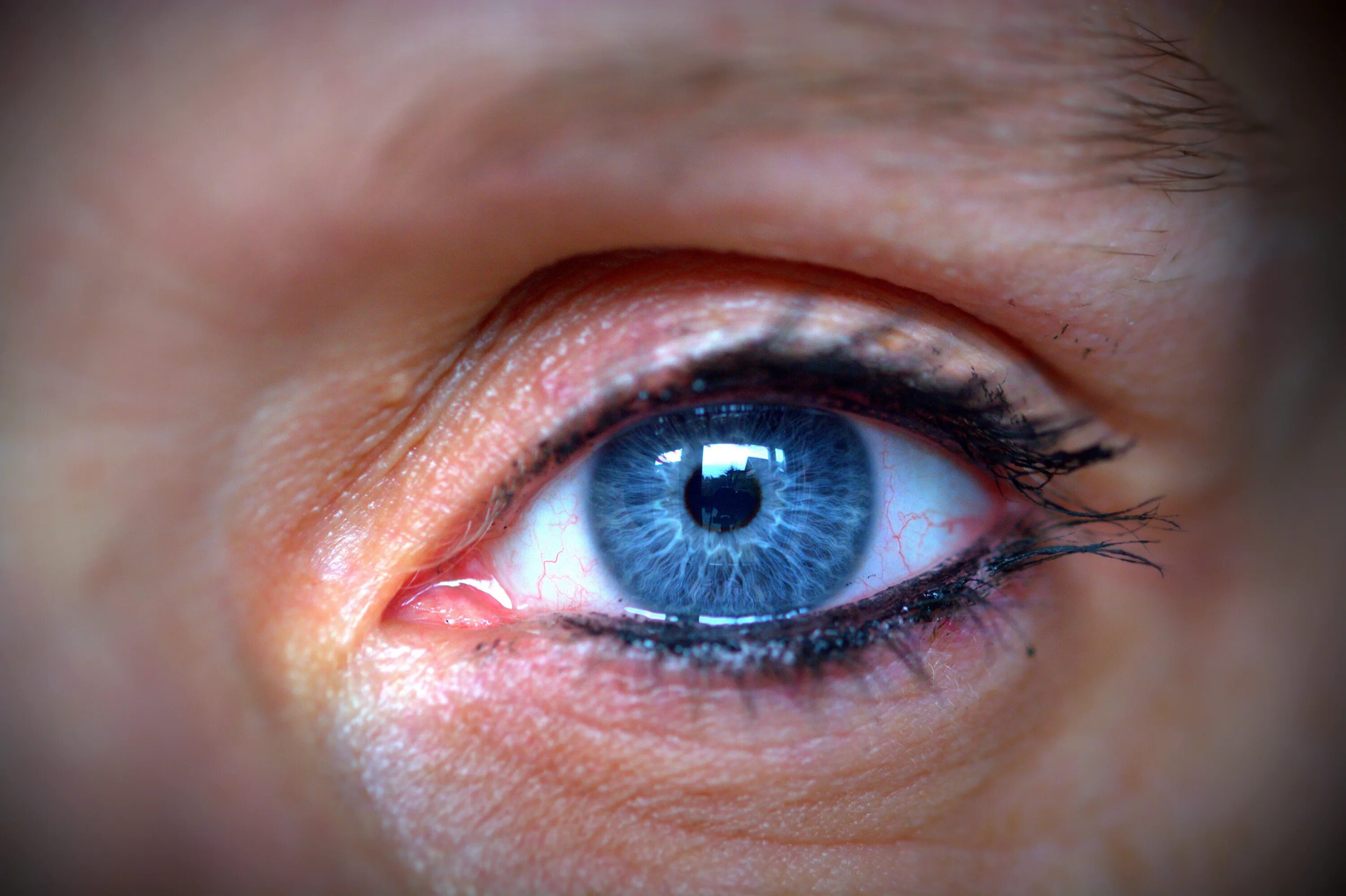 Eye search