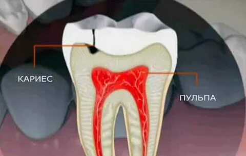 Болят зубы изнутри