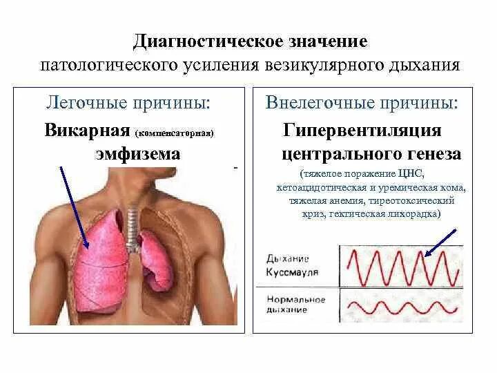 Компенсаторная эмфизема. Компенсаторная эмфизема легких. Патологическое усиление везикулярного дыхания. Викарная эмфизема лёгких что это. Дыхание ясное везикулярное