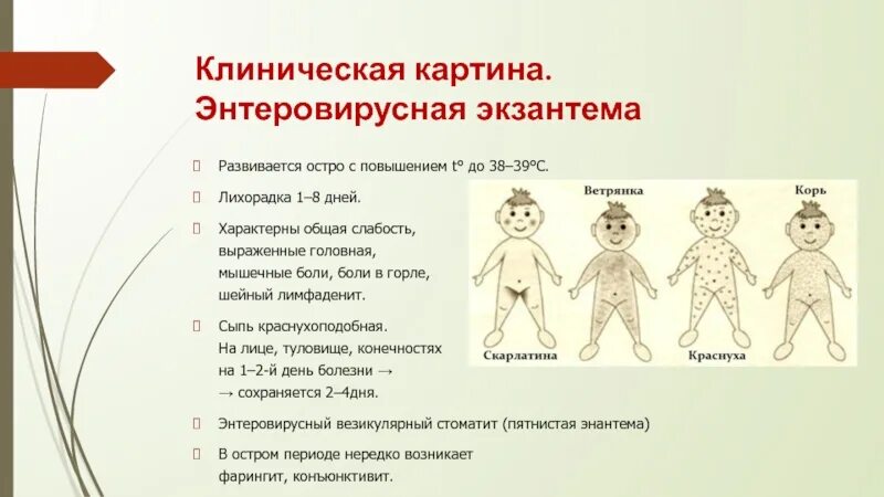 Высыпания при детских инфекциях. Сыпь при детских инфекционных болезнях.