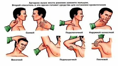 Общие мероприятия при наружных кровотечениях